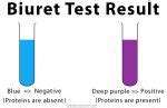 Biuret Test: Definition, Theory, Procedure, and .